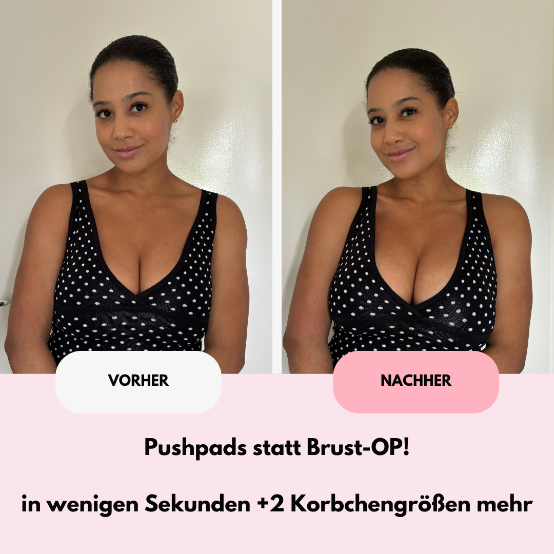 MYNIPAD Pushpads - Doppelseitig klebende Brusteinsätze